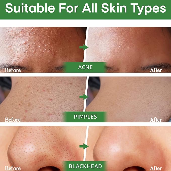 Green Tea Deep Cleansing Mask - SKIN TRUST