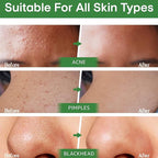 Green Tea Deep Cleansing Mask - SKIN TRUST