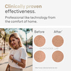 Painless IPL Hair Removal Device - SKIN TRUST