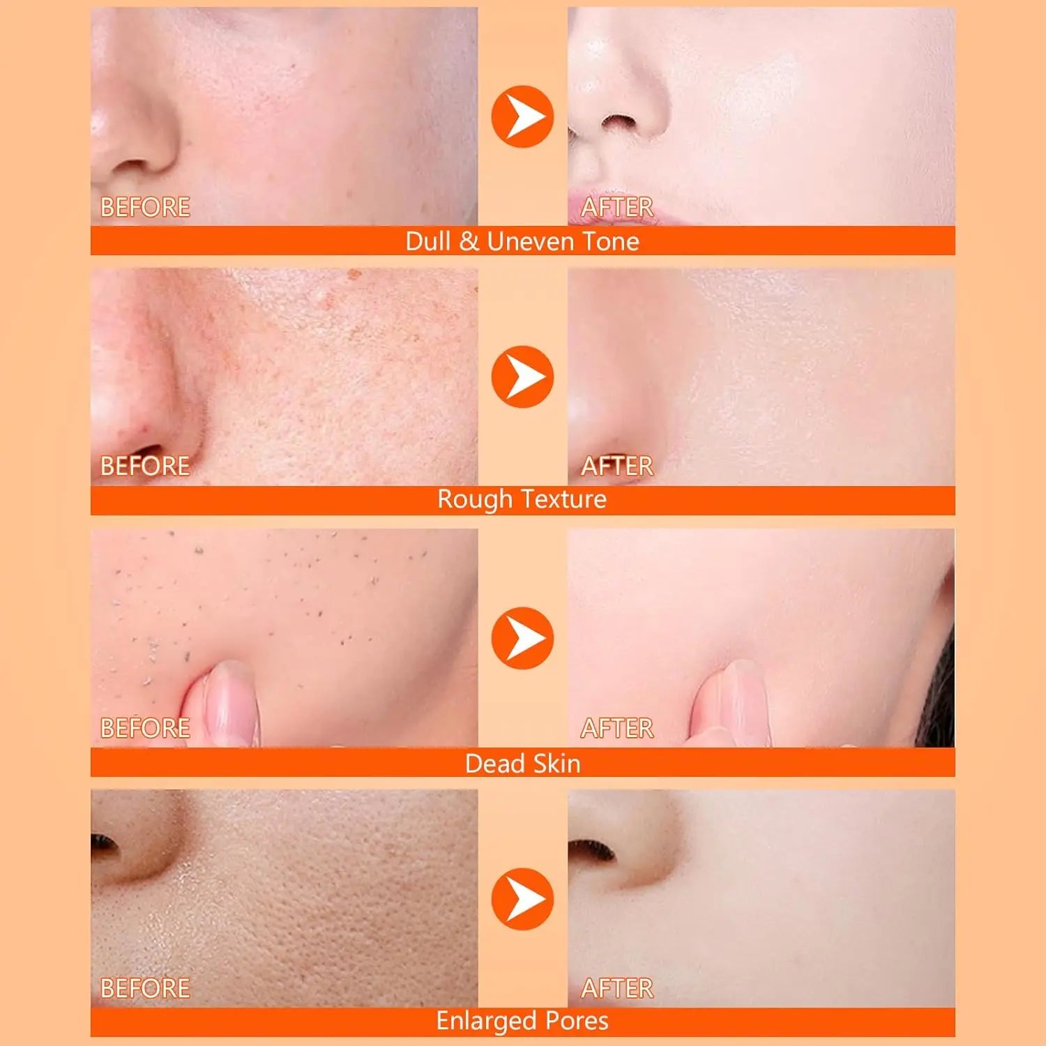 Kojic Turmeric Exfoliating Body Spray - SKIN TRUST