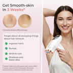 Painless IPL Hair Removal Device - SKIN TRUST