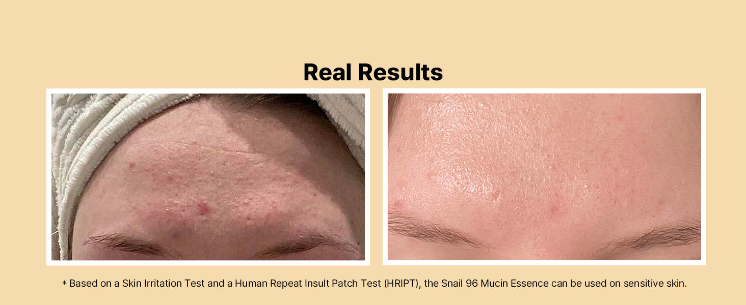 COSRX Snail Mucin 96% Power Repairing Essence 100ml, Hydrating Serum for Face with Snail Secretion Filtrate for Dull Skin & Fine Lines, Korean Skincare - SKIN TRUST