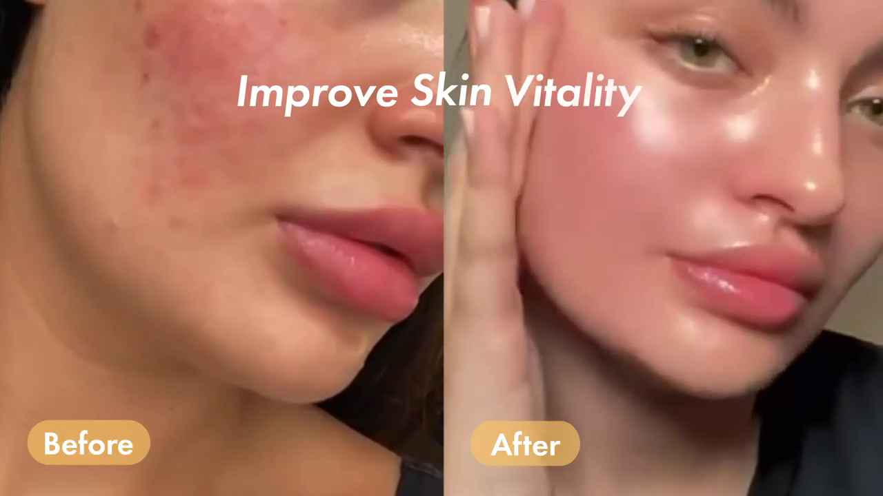 COSRX Snail Mucin 96% Power Repairing Essence 100ml, Hydrating Serum for Face with Snail Secretion Filtrate for Dull Skin & Fine Lines, Korean Skincare - SKIN TRUST